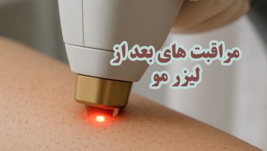 مراقبت پوستی بعد از لیزرمو