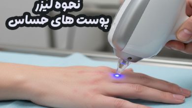 نحوه لیزر پوست های حساس