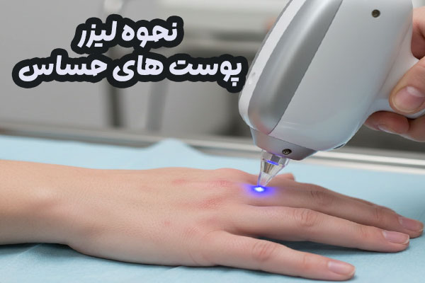 نحوه لیزر پوست های حساس