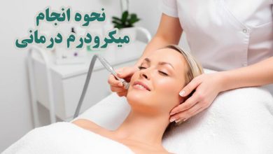 انجام میکرودرم