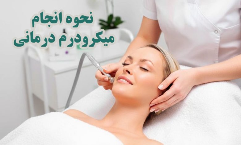 انجام میکرودرم