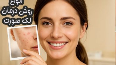 انواع روش درمان لک