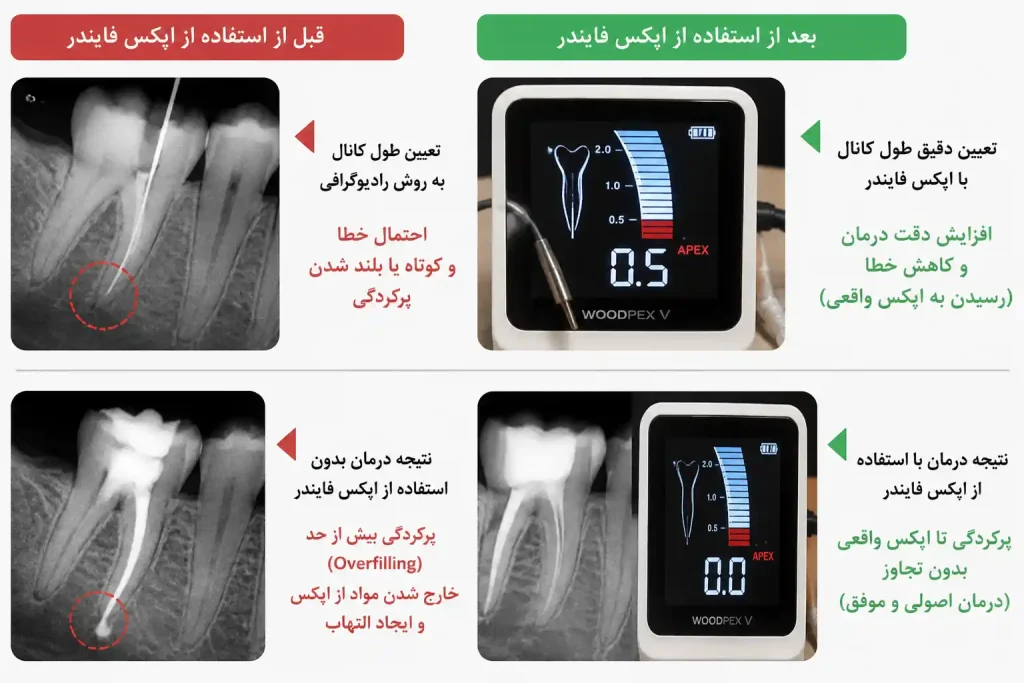 اپکس فایندر