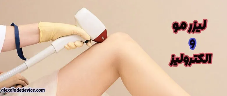 لیزر مو و الکترولیز