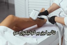 تاثیر لیزر بر فولیکول‌ مو
