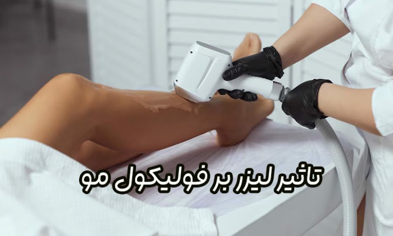 تاثیر لیزر بر فولیکول مو