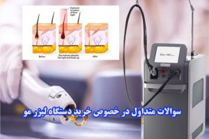 فروش دستگاه لیزر در کرج